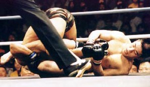 �A���̘r�\��